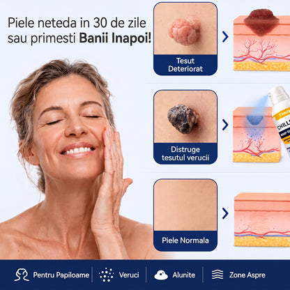 DermClear™ - Spray negi si papiloame