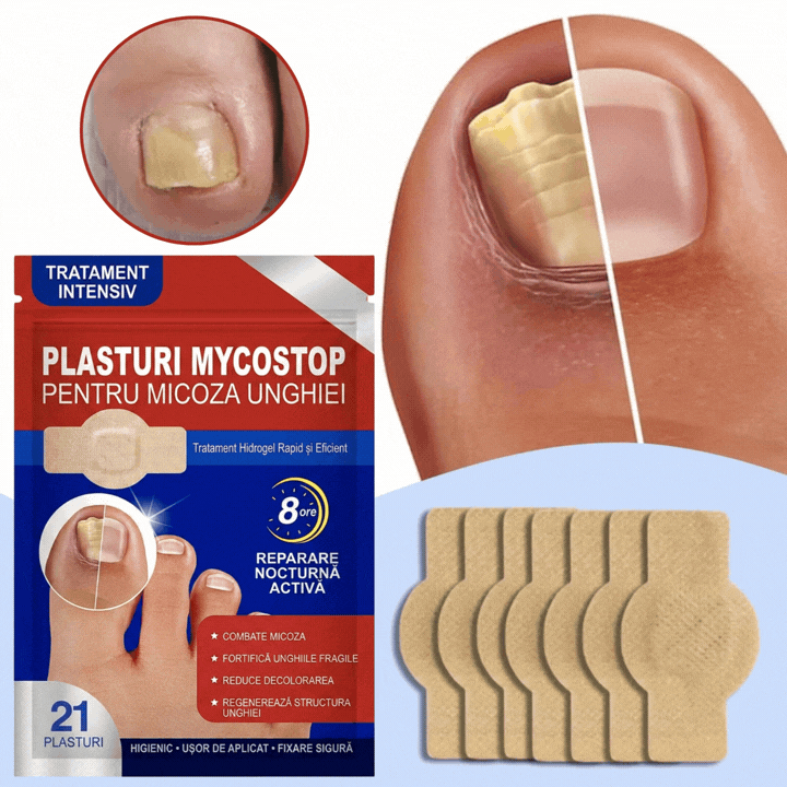 Plasturi pentru tratamentul unghiilor MycoStop