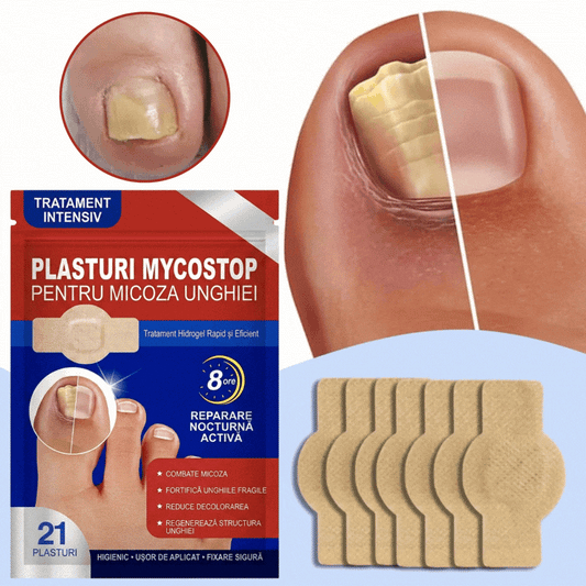 Plasturi pentru tratamentul unghiilor MycoStop